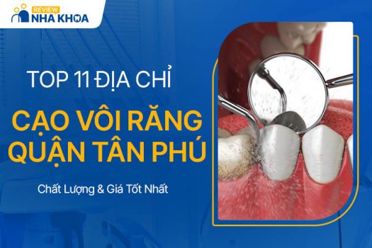 Chia Sẻ 11 Địa Chỉ Cạo Vôi Răng Quận Tân Phú Chất Lượng