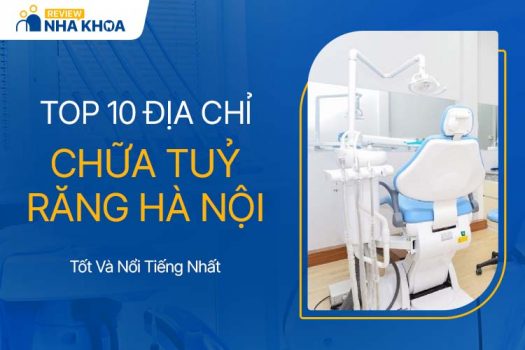 Top 10 Địa Chỉ Chữa Tuỷ Răng Tốt Và Nổi Tiếng Nhất Hà Nội