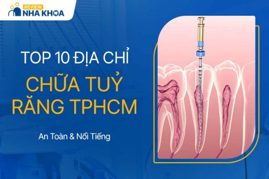 Top 10 Địa Chỉ Chữa Tuỷ Răng An Toàn Và Uy Tín Tại TPHCM