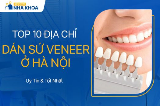 Review 10 Địa Chỉ Dán Sứ Veneer Tốt Và Nổi Tiếng Ở Hà Nội