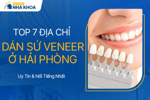 6 Địa Chỉ Nha Khoa Dán Sứ Veneer Tốt Nhất Ở Hải Phòng