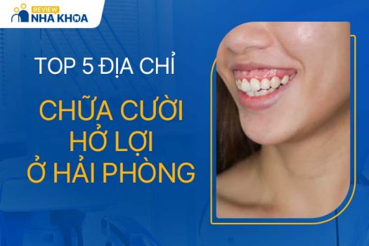 Danh Sách 5 Địa Chỉ Chữa Cười Hở Lợi Chất Lượng Ở Hải Phòng