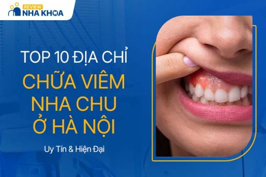 Top 10 Địa Chỉ Chữa Viêm Nha Chu Ở Hà Nội Uy Tín, Hiện Đại