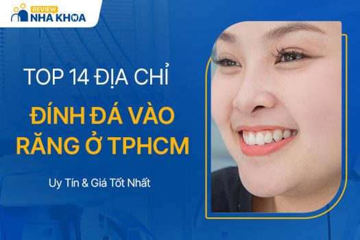 địa chỉ đính đá vào răng tphcm