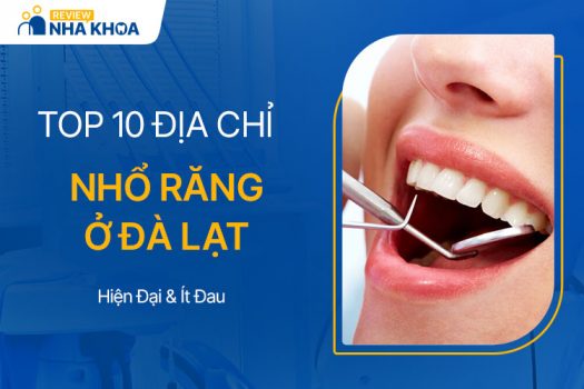 TOP 5 Địa Chỉ Nhổ Răng Ở Đà Lạt Hiện Đại, Ít Đau, Giá Rẻ