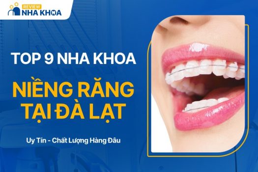 Địa chỉ niềng răng uy tín tại Đà Lạt