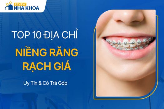 địa chỉ niềng răng Rạch Giá