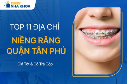 11 Địa Chỉ Niềng Răng Tân Phú Uy Tín, Giá Tốt, Có Trả Góp