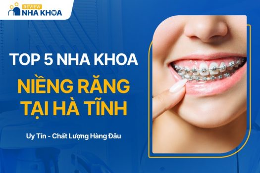 Địa chỉ niềng răng ở Hà Tĩnh uy tín, giá tốt