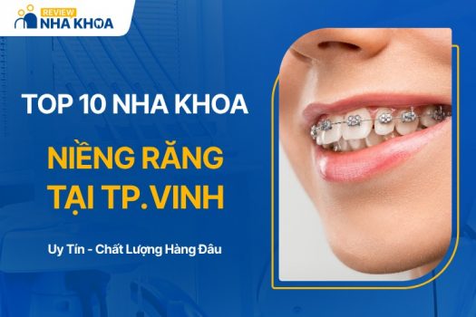 Địa chỉ niềng răng tại thành phố Vinh