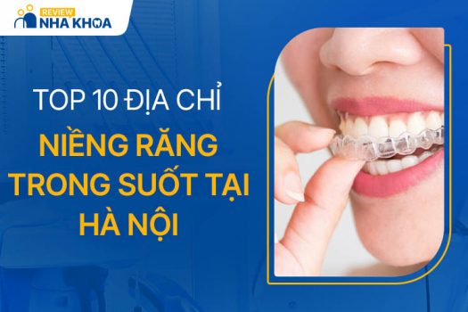 Top 10 Địa Chỉ Niềng Răng Trong Suốt Hà Nội Tốt Nhất