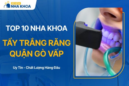 TOP 10 Địa Chỉ Tẩy Trắng Răng Gò Vấp Chất Lượng, Giá Tốt