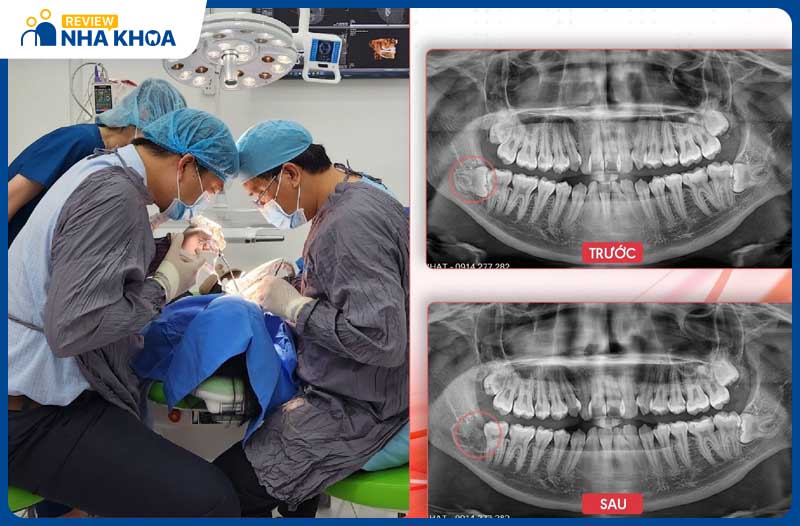 Bác sĩ của Nha khoa Việt Nhật có khả năng xử lý trường hợp răng khôn mọc ngầm