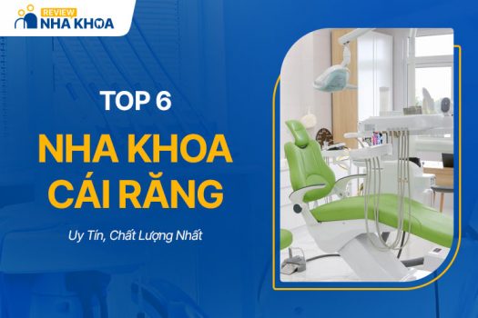 Top 6 Nha Khoa Cái Răng Uy Tín, Chất Lượng Tốt Nhất