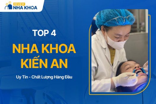 Top 4 Địa Chỉ Nha Khoa Kiến An Chất Lượng - Giá Tốt