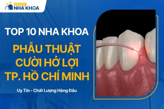 Nha khoa phẫu thuật cười hở lợi ở TPHCM uy tín