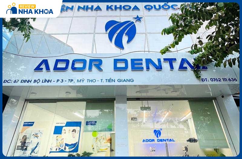 Nha Khoa Ador xứng tầm quốc tế, được nhiều người lựa chọn