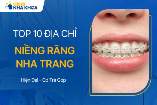 Top 10 Địa Chỉ Niềng Răng Nha Trang Hiện Đại, Có Trả Góp