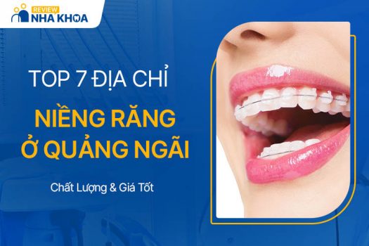 Top 07 Địa Chỉ Niềng Răng Quảng Ngãi Chất Lượng, Giá Tốt