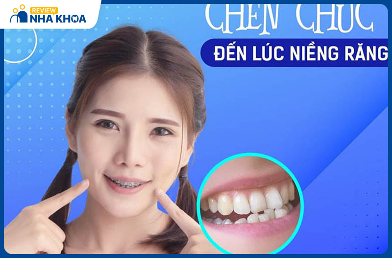 Nha khoa An Định ở Quy Nhơn niềng răng an toàn và hiệu quả hơn với công nghệ iTero 5D