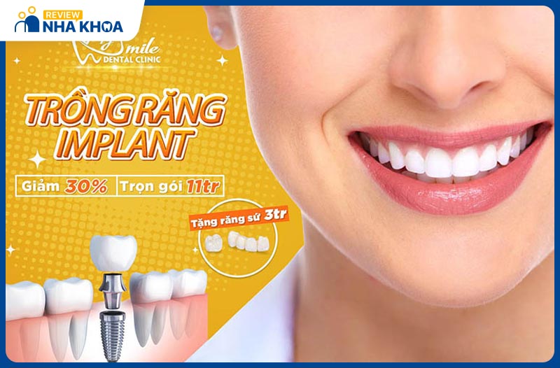 Nha khoa Quốc tế My Smile Đà Nẵng trồng răng Implant với chi phí hợp lý, cam kết đạt hiệu quả cao