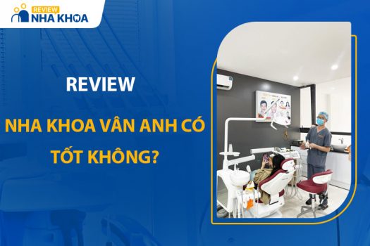 Nha Khoa Vân Anh Có Tốt Không? Review Chi Tiết Nhất