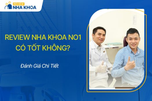 Review Nha Khoa No1 Có Tốt Không, Nên Chọn Không?