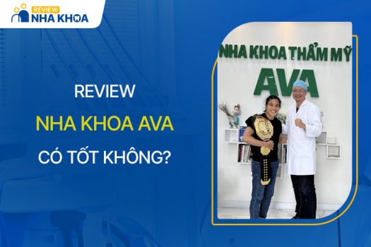 Nha Khoa Ava Có Tốt Không? Review Bác Sĩ, Dịch Vụ