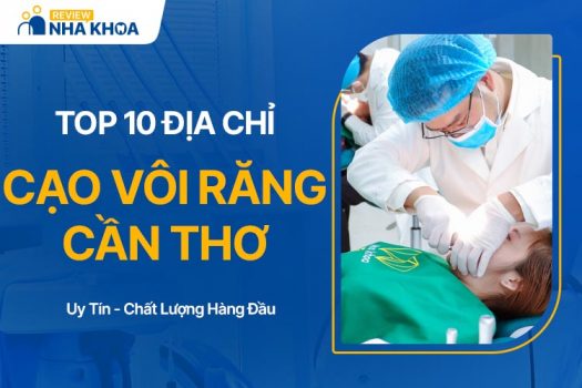 10 Địa Chỉ Cạo Vôi Răng Cần Thơ Uy Tín, Chất Lượng