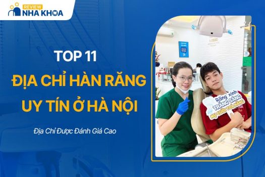 Top 11 Địa Chỉ Hàn Răng Uy Tín Ở Hà Nội Được Đánh Giá Cao