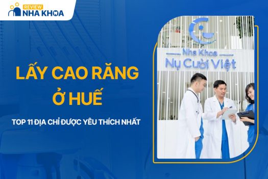 Top 11 Địa Chỉ Lấy Cao Răng Ở Huế Được Yêu Thích Nhất