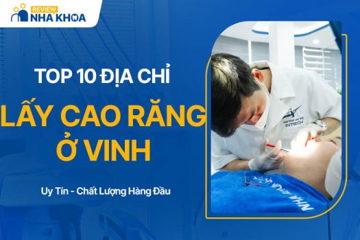 10 Địa Chỉ Lấy Cao Răng Ở Vinh Đáng Tin Cậy, Giá Phải Chăng