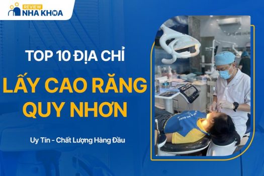 10 Địa Chỉ Lấy Cao Răng Quy Nhơn Uy Tín Nhất Hiện Nay