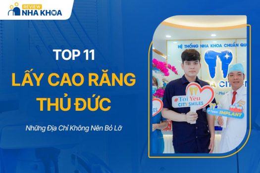 Lấy Cao Răng Thủ Đức: Top 11 Địa Chỉ Không Nên Bỏ Lỡ