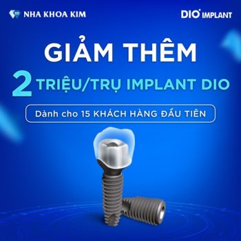 Giảm thêm 2 triệu đồng trụ Implant DIO