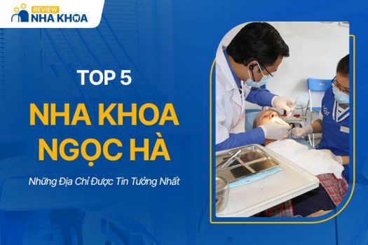 Top 5 Nha Khoa Ngọc Hà Tốt, Được Tin Tưởng Nhất