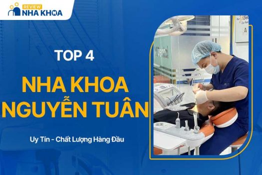 Top 4 Nha Khoa Nguyễn Tuân Chất Lượng Hàng Đầu Hiện Nay