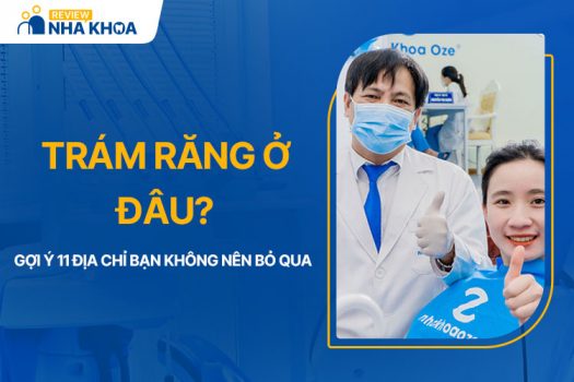 Trám Răng Ở Đâu? Gợi Ý 11 Địa Chỉ Bạn Không Nên Bỏ Qua