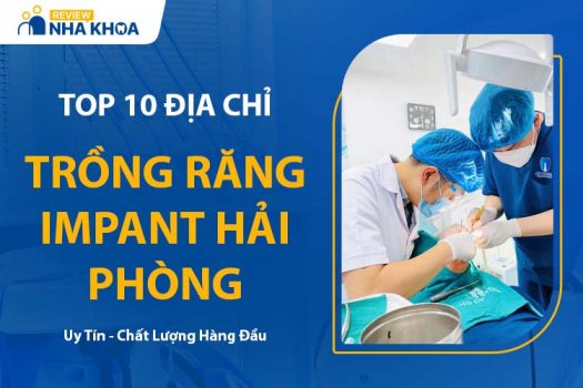 10 Địa Chỉ Trồng Răng Implant Hải Phòng Uy Tín, An Toàn