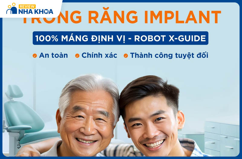 Chương trình ưu đãi giảm giá cho dịch vụ trồng răng implant