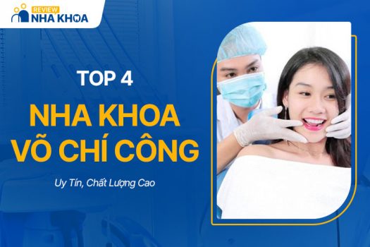 Top 4 Nha Khoa Võ Chí Công Uy Tín, Chất Lượng Cao