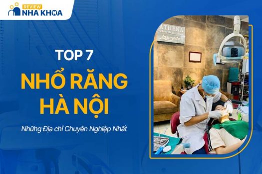 Top 7 Địa Chỉ Nhổ Răng Hà Nội Không Đau, Chuyên Nghiệp Nhất