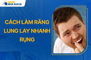 Cách Làm Răng Lung Lay Nhanh Rụng Đơn Giản Bạn Có Thể Thử Ngay