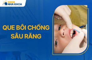 Que Bôi Chống Sâu Răng Là Gì? Cách Sử Dụng Và Lưu Ý