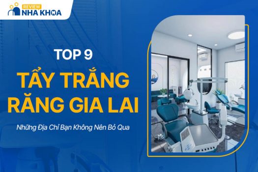 Top 9 Địa Chỉ Tẩy Trắng Răng Gia Lai Bạn Không Nên Bỏ Qua