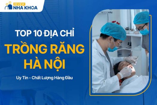 10 Địa Chỉ Trồng Răng Hà Nội Được Đánh Giá Cao Nhất