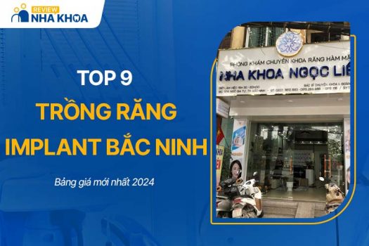 Top 9 Địa Chỉ Trồng Răng Implant Bắc Ninh Tốt Và Uy Tín Nhất