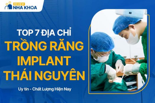 7 Địa Chỉ Trồng Răng Implant Thái Nguyên Chất Lượng, An Toàn 