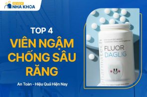 Top 4 Viên Ngậm Chống Sâu Răng An Toàn, Hiệu Quả Nhất 