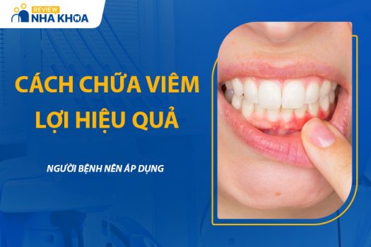 Các Cách Chữa Viêm Lợi Hiệu Quả Người Bệnh Nên Áp Dụng
